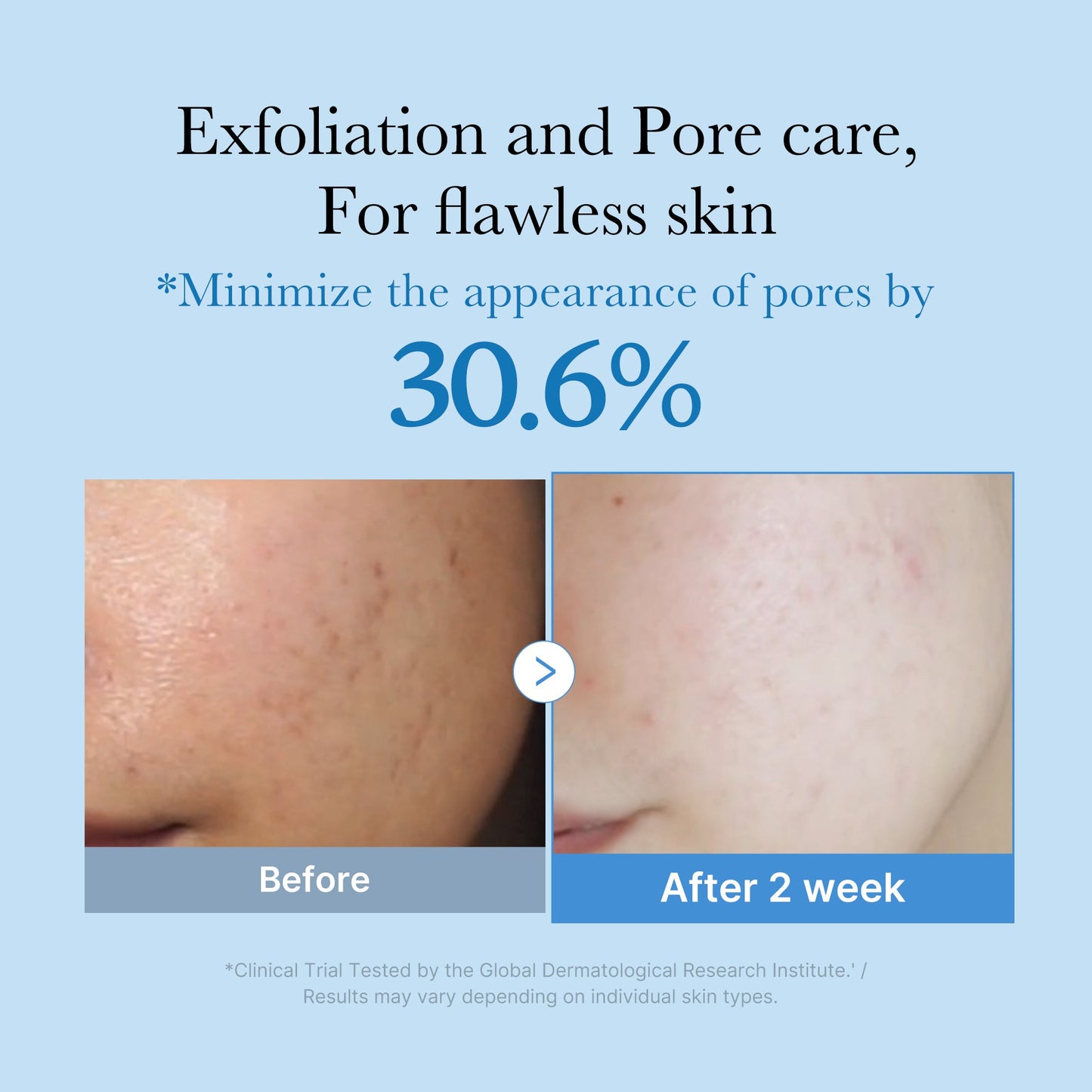 zero-pore-toner-k1 01_d6480b4e-3c08-4954-994a-ed5212c1839c.jpg