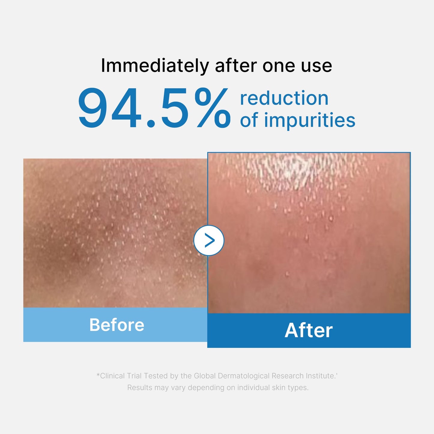 zero-pore-blackhead-deep-cleansing-oil-u0 01_eed557ec-5857-46a2-8b17-dbd67c692dcb.jpg
