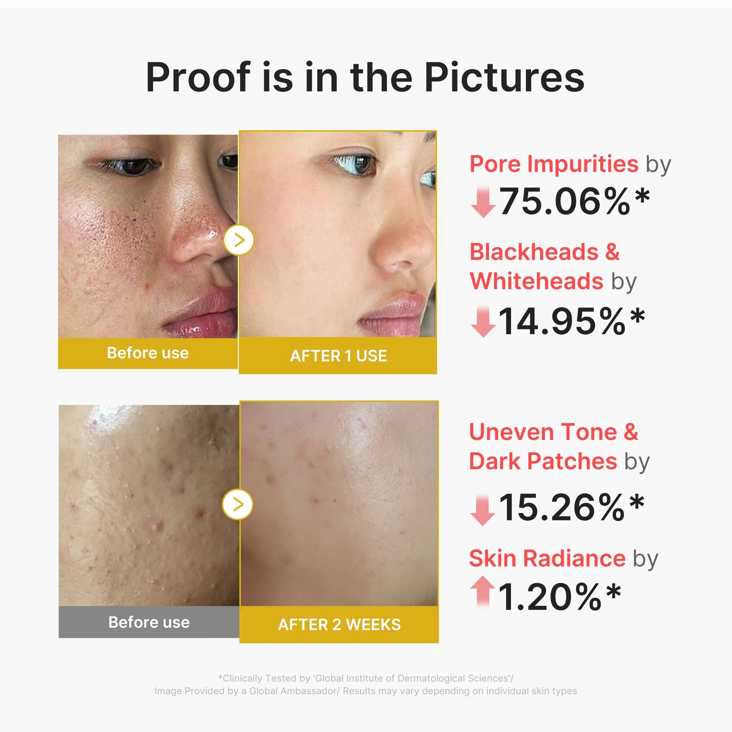 kojic-acid-turmeric-peel-shot-u6 02_45fe66d3-b3f6-4100-aa52-2afd7eded417.jpg