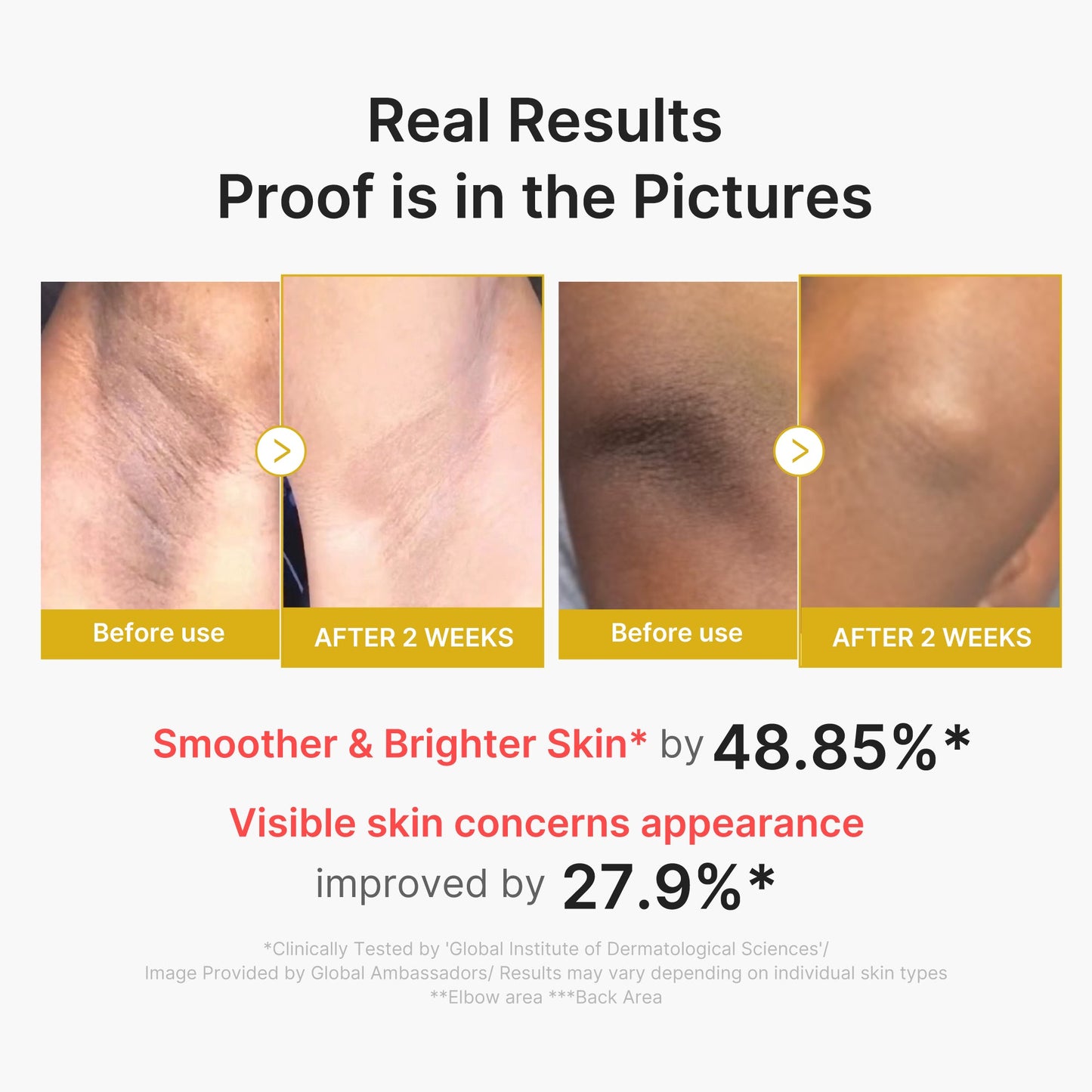 kojic-acid-turmeric-body-peel-shot-d9 02_72880cfc-382b-440b-8152-7e3dce87da2a.jpg
