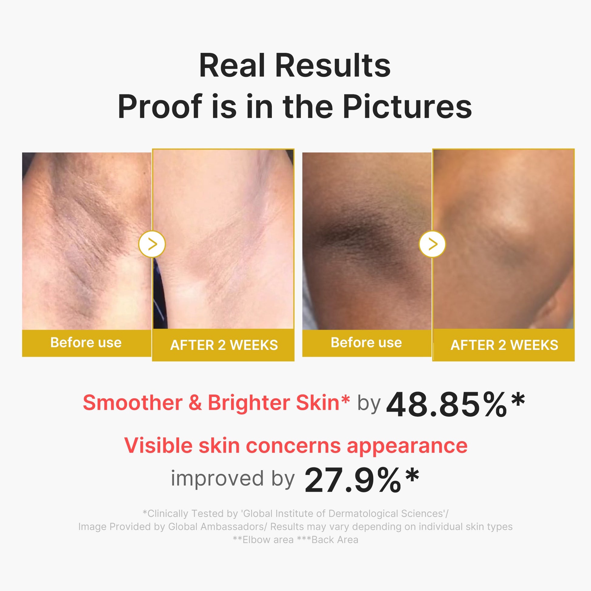 kojic-acid-turmeric-body-peel-shot-d9 02_72880cfc-382b-440b-8152-7e3dce87da2a.jpg
