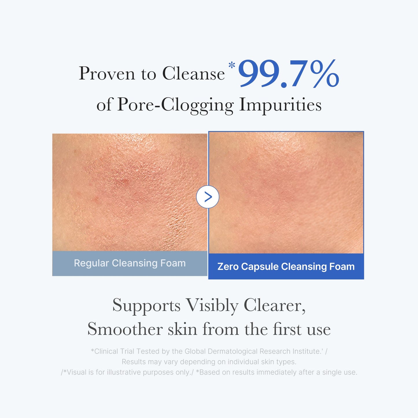zero-pore-capsule-cleansing-foam-r3 02_c1fb9dfb-86c5-4038-8ff8-490d1006276c.jpg