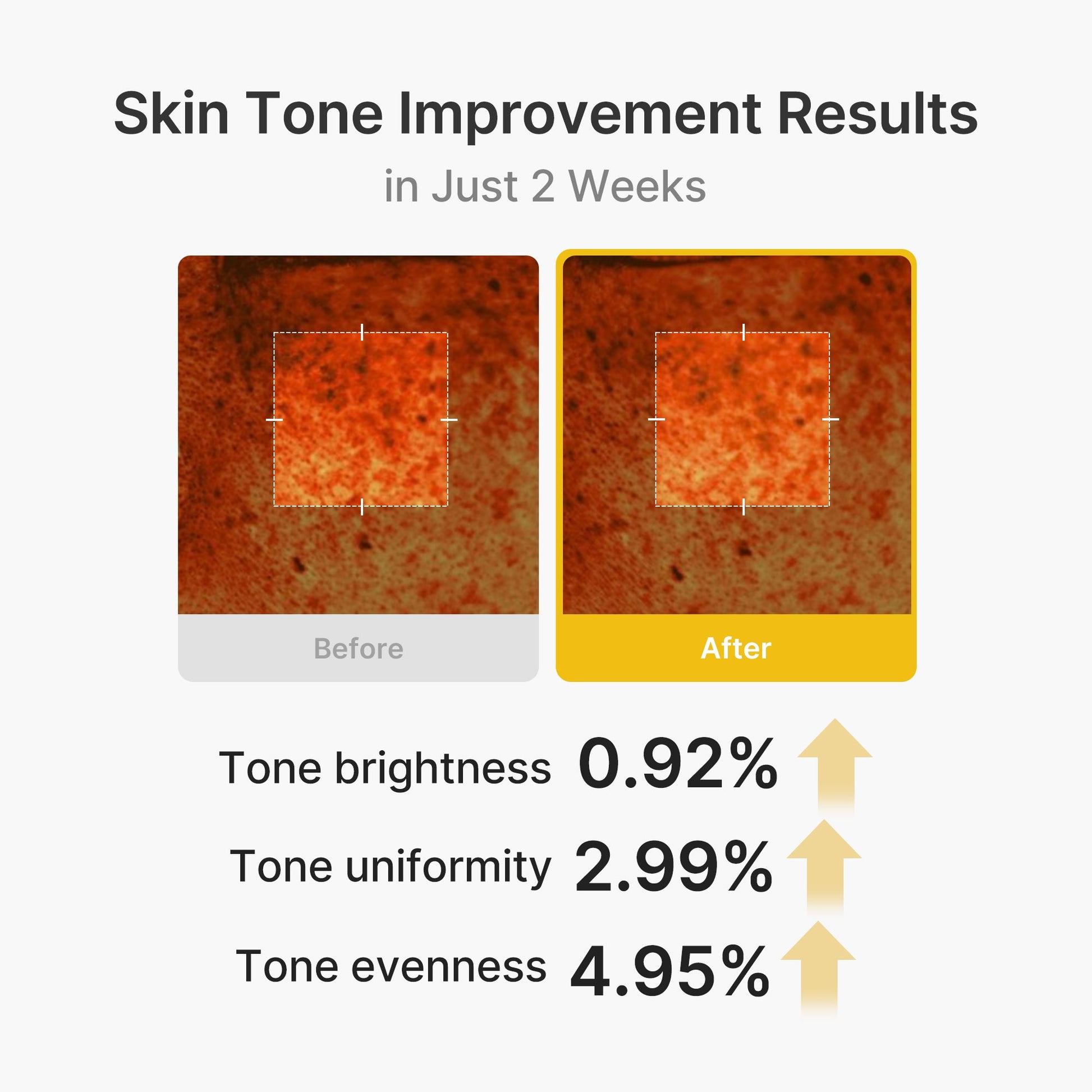 kojic-acid-turmeric-vita-capsule-cream-w1 03_2b626701-fc6c-4702-9e96-a2157a4f7f9d.jpg