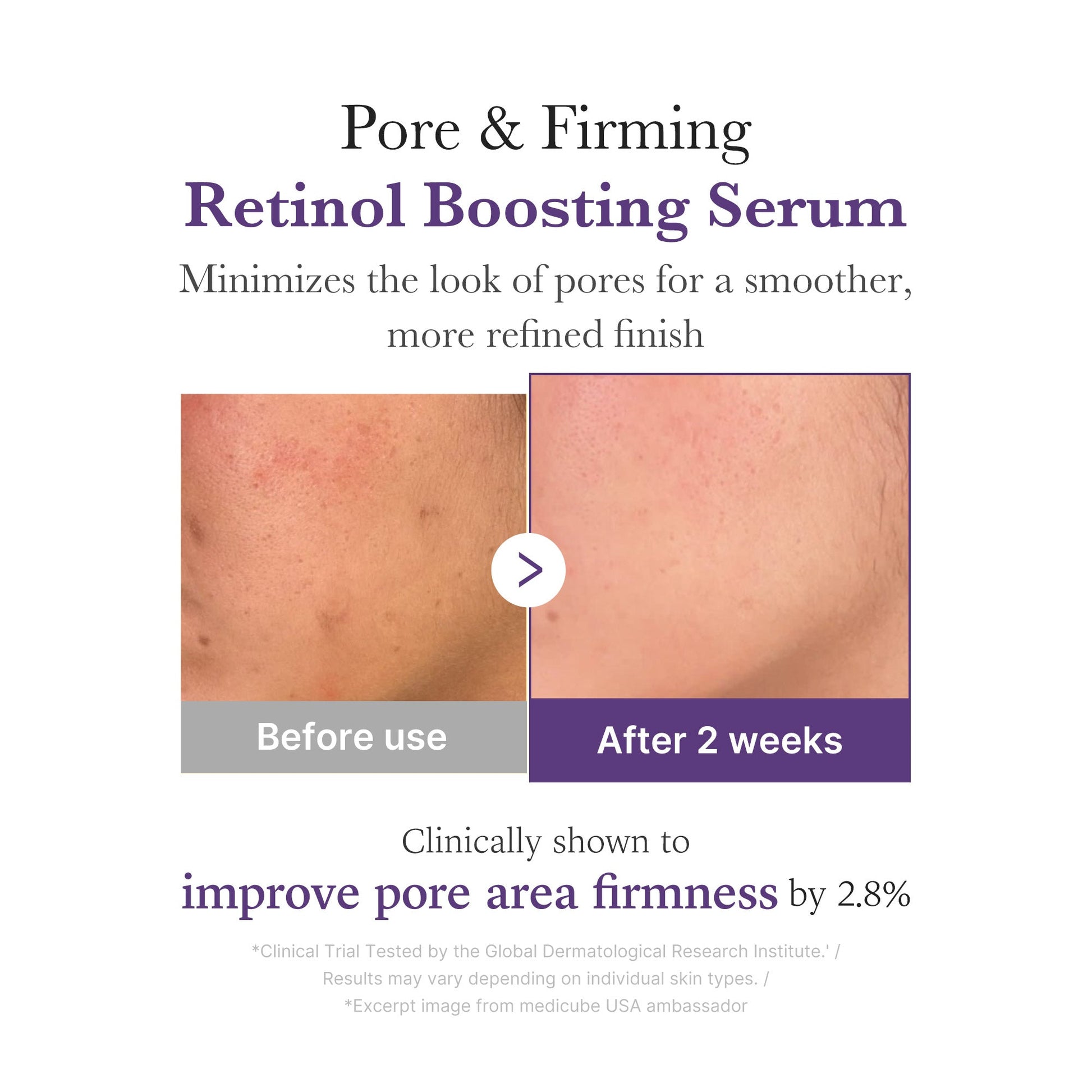 retinol-nmn-boosting-serum-s5 03_3510e7a5-5633-4a18-81ea-1389593bd517.jpg