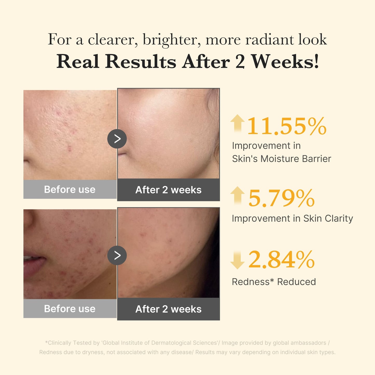 kojic-acid-turmeric-capsule-serum-a7 03_436487f5-76df-490e-8a61-01118373efbd.jpg