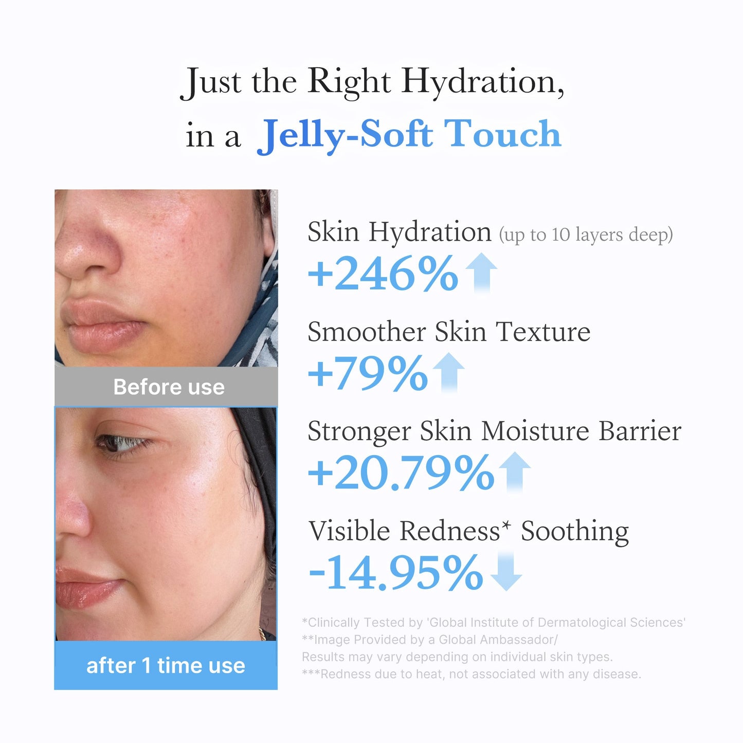 hyaluronic-ceramide-moisturizing-jelly-cream-j4 03_c39d66cc-0839-4e48-ab4a-d32143d06b1c.jpg