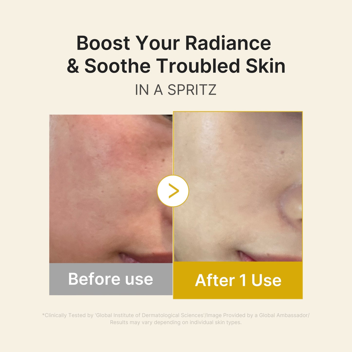 kojic-acid-turmeric-vitamin-gold-jelly-mist-serum-d9 03_dc9cd19e-4e57-49d3-9b66-c7762e8a63f1.jpg