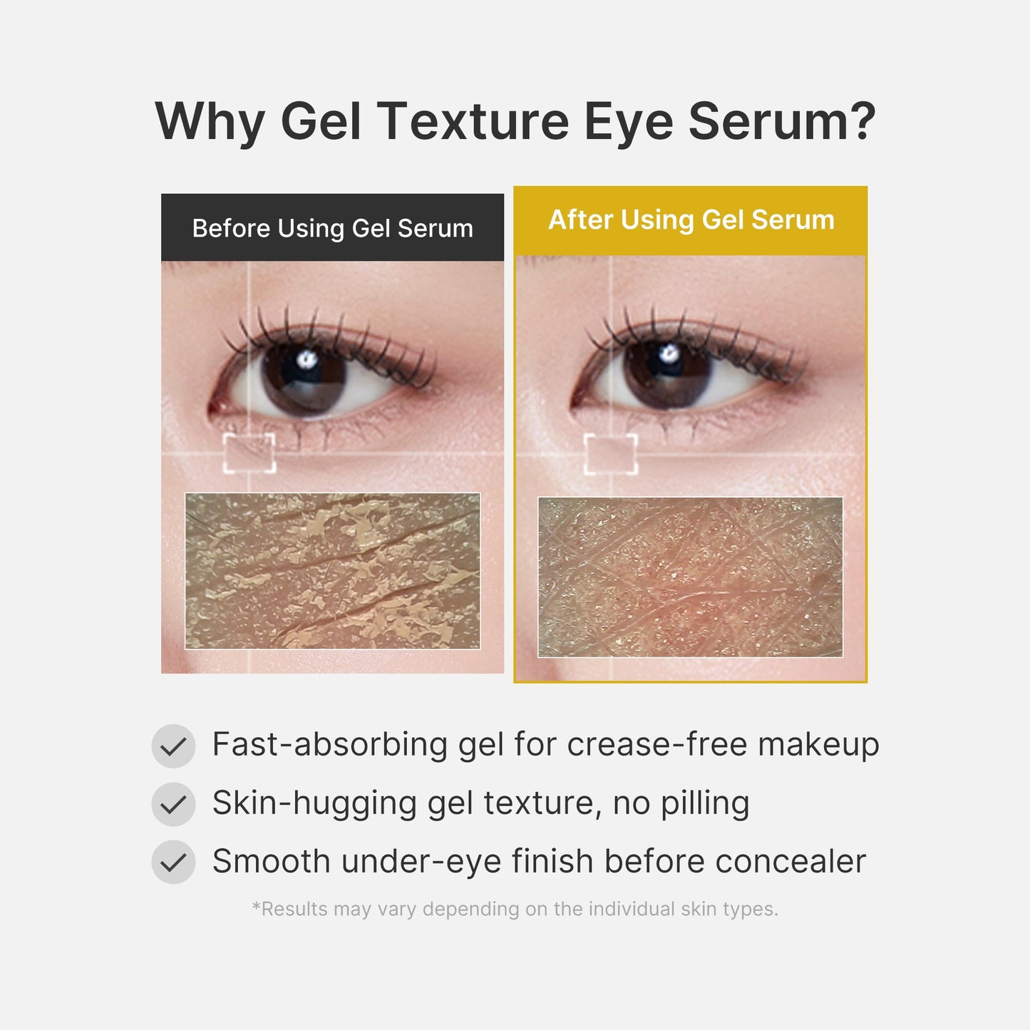 kojic-acid-tumeric-eye-gel-serum-w5 04_0487ef36-49f4-4294-8049-bb55118b05fe.jpg