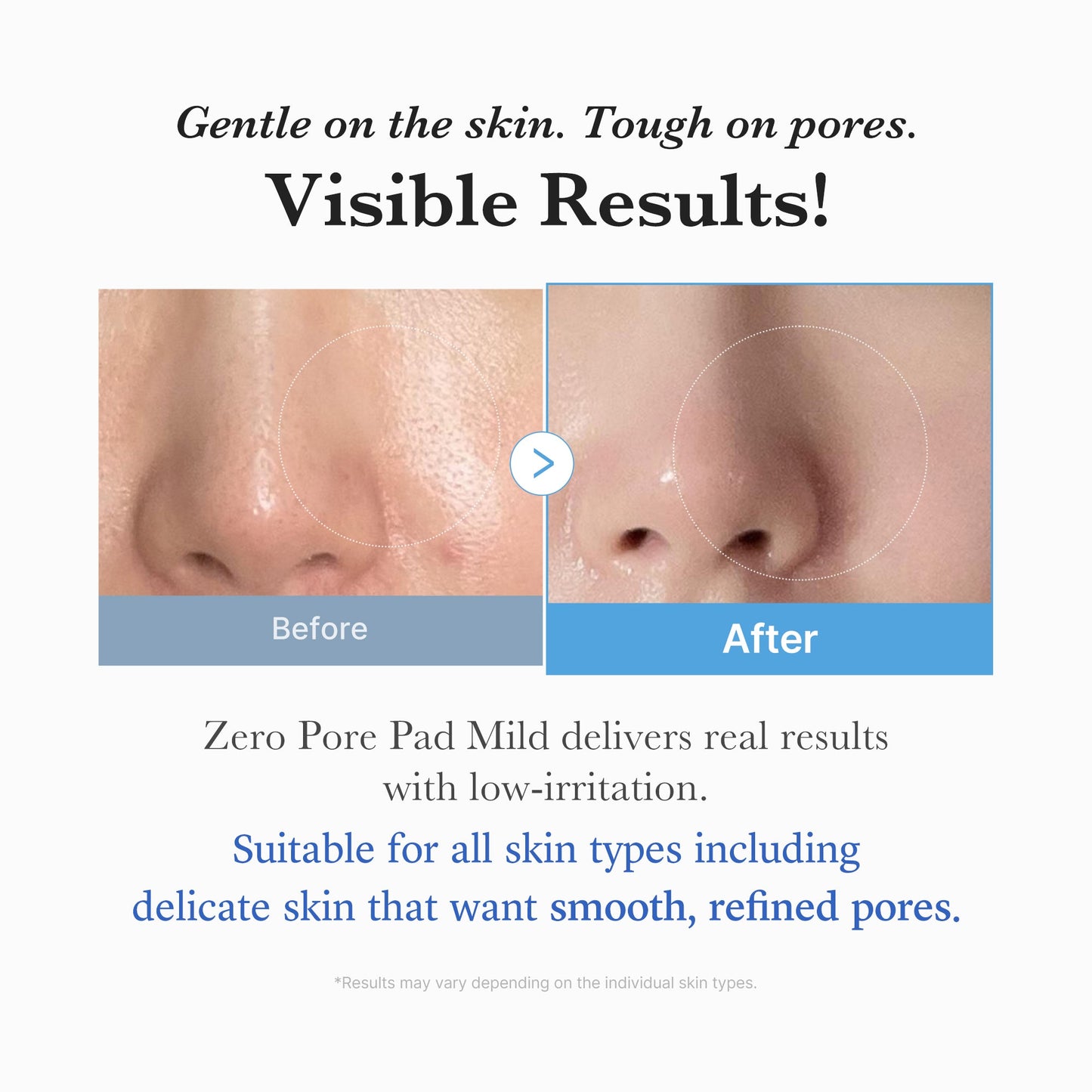 zero-pore-madecassoside-pads-mild-u2 04_6357f9f9-483b-4891-82c6-a58d336e62c8.jpg