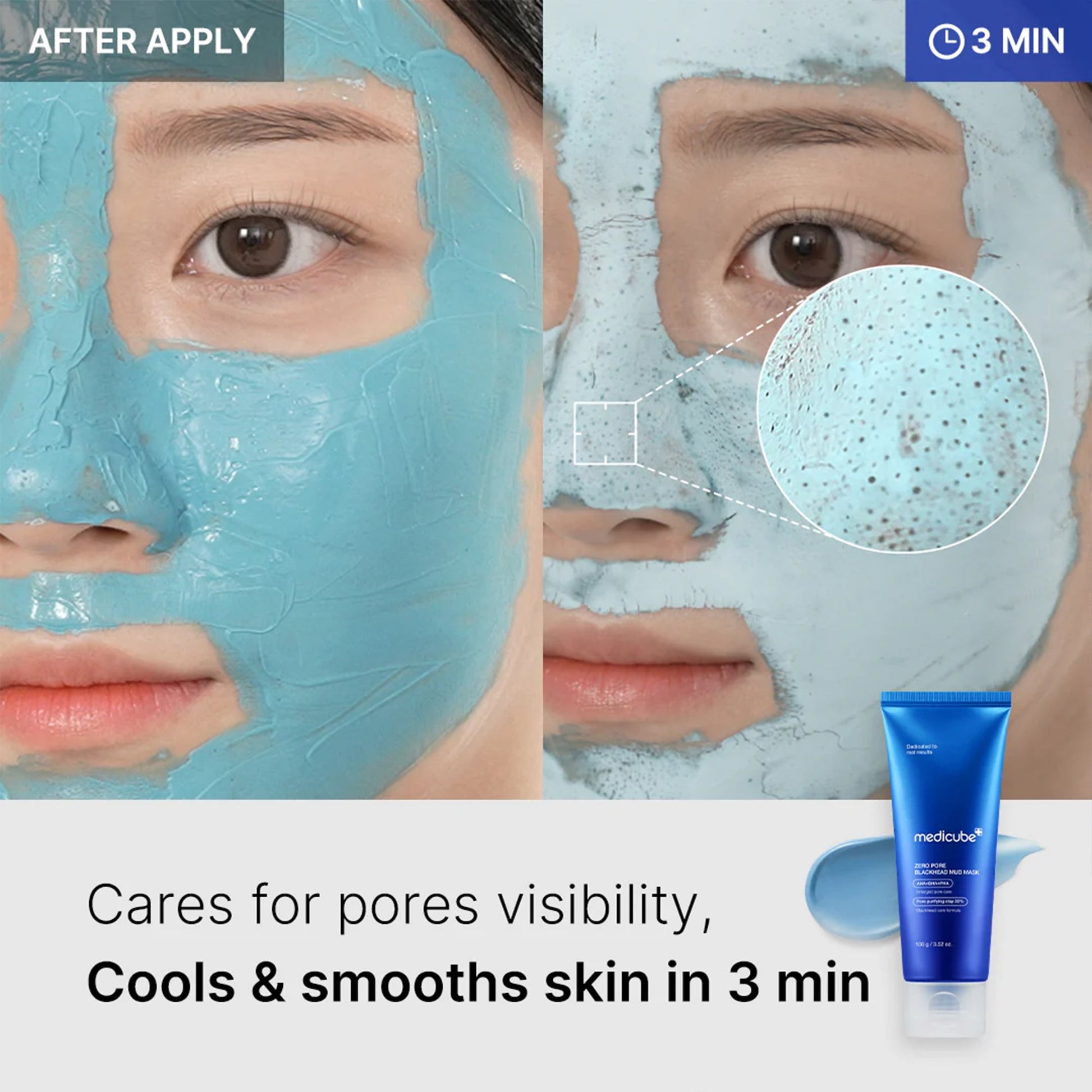 zero-pore-blackhead-mud-mask-q6 04_867c0459-a94e-40d3-bd9a-70400edabe8d.jpg