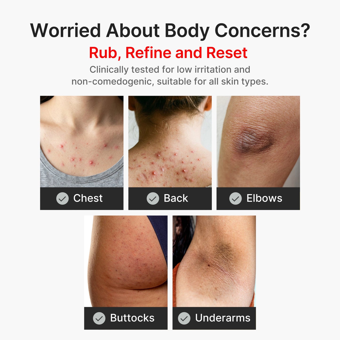 kojic-acid-turmeric-body-peel-shot-d9 04_8a7237f2-3ebf-401e-bd85-54841aeb3efc.jpg
