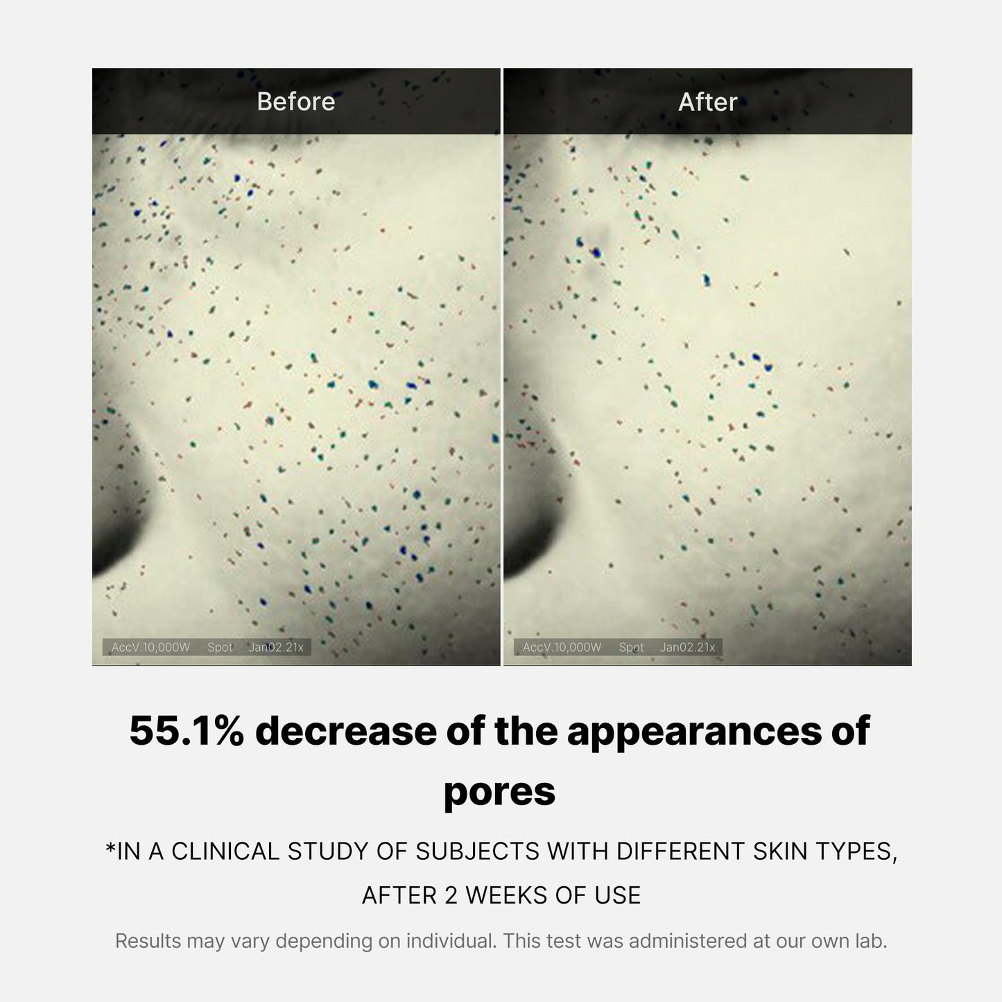 pore-care-duo-l8 05_12ddab8a-64be-4612-8ee1-27e5ec701921.jpg