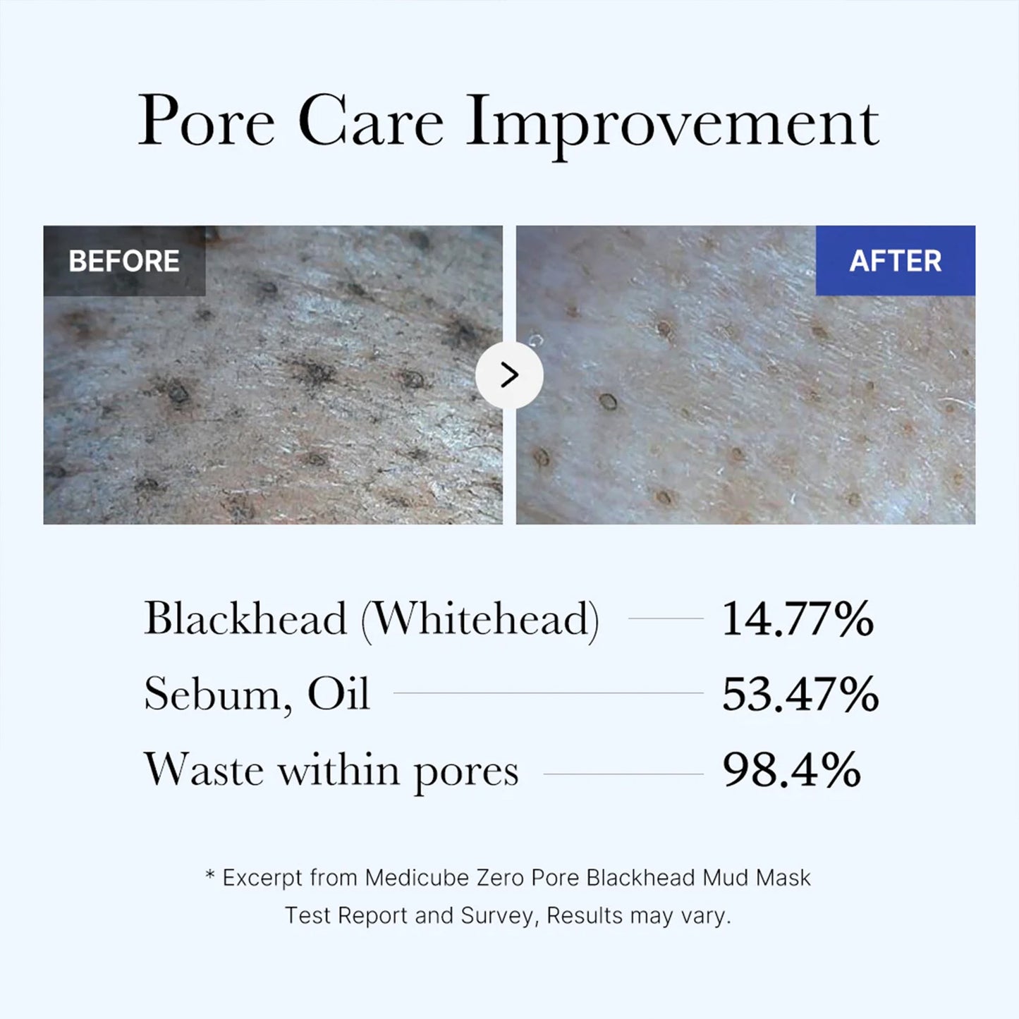 zero-pore-blackhead-mud-mask-q6 05_9362a158-c2b3-4525-acc0-631a2cfdea47.jpg