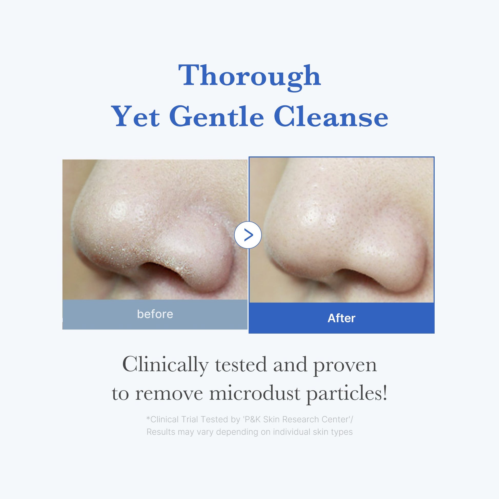 zero-foam-cleanser-e4 250702_ZeroCleanser3.jpg