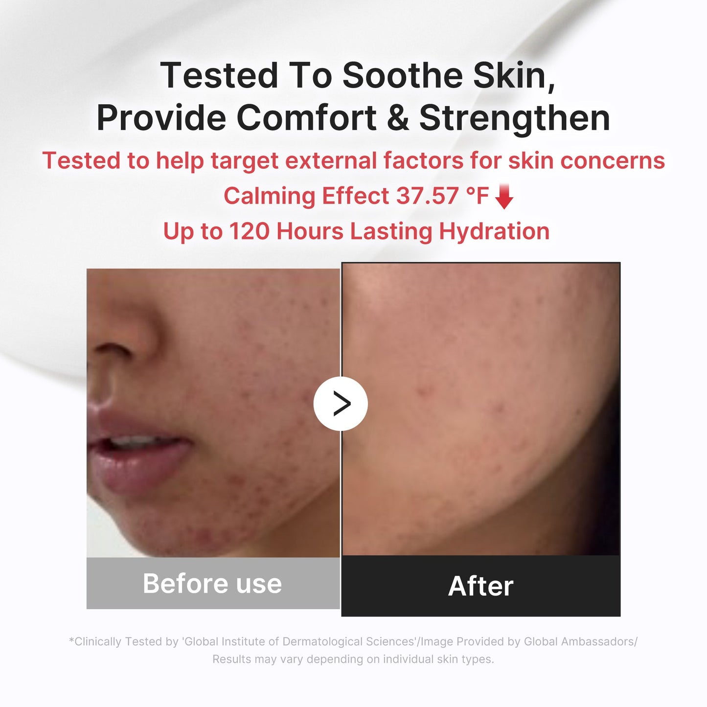 3h-daily-relief-cream-v9 3H_03.jpg