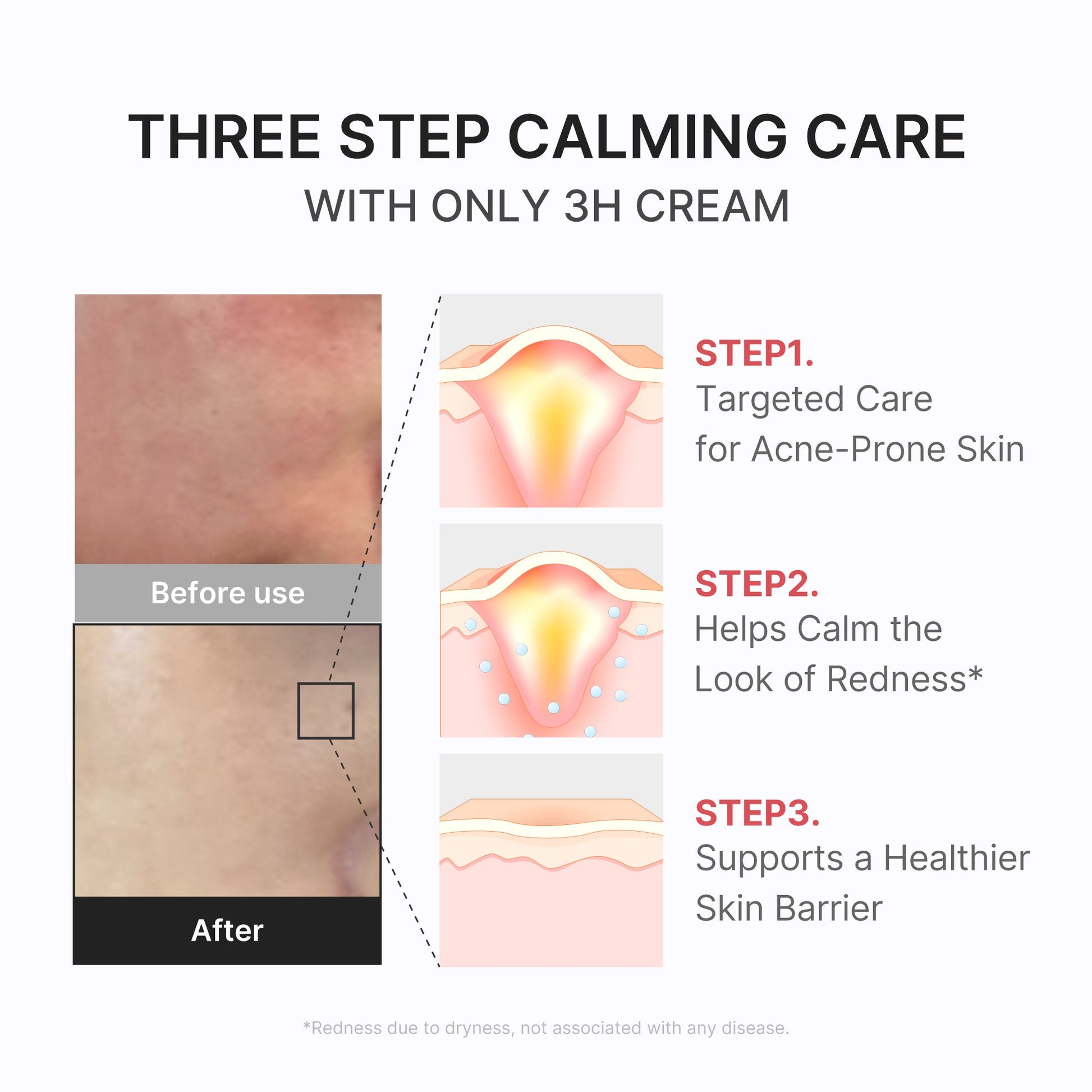 3h-daily-relief-cream-v9 3H_04.jpg