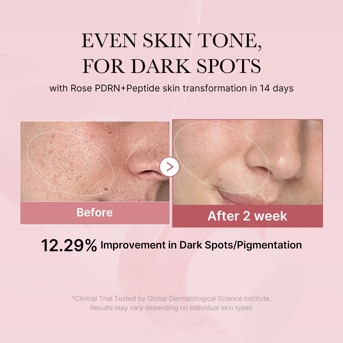 pdrn-pink-peptide-toner-c6 PDRN_01_308c518e-5ac6-4e54-99bd-eabc8796739b.jpg