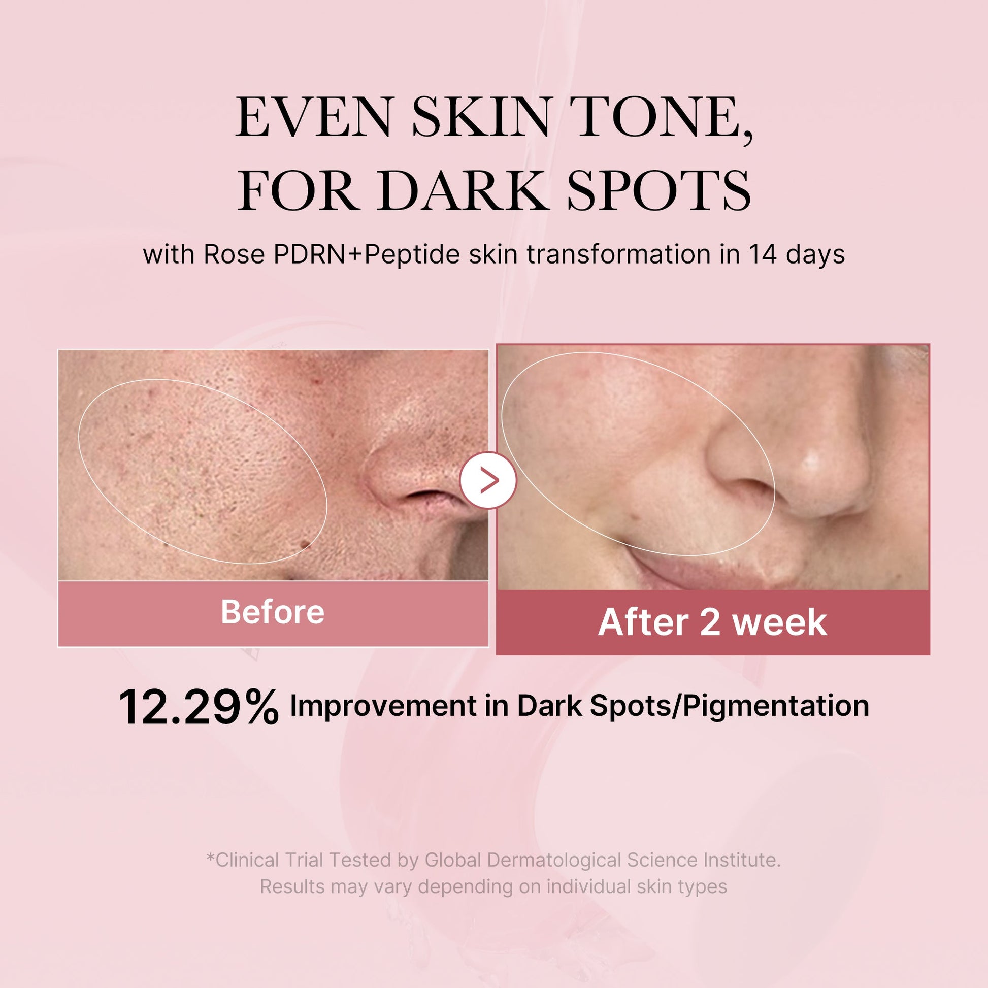 pdrn-pink-peptide-toner-c6 PDRN_01_308c518e-5ac6-4e54-99bd-eabc8796739b.jpg