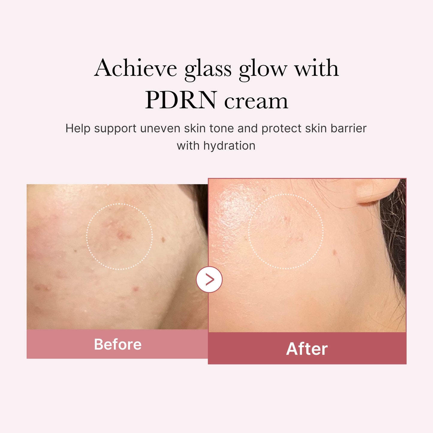 pdrn-pink-peptide-cream-e1 PDRN_02_d7805bfe-cf43-446a-b71b-a276683f136b.jpg