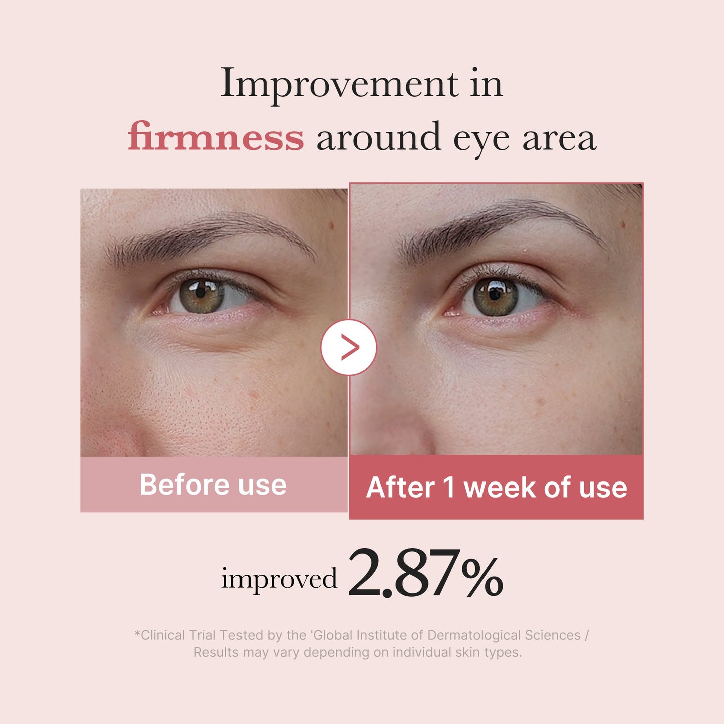 pdrn-pink-peptide-eye-cream-f4 PDRN_03_256dd753-0a2f-41b4-b3cd-bbfd3bc27018.jpg