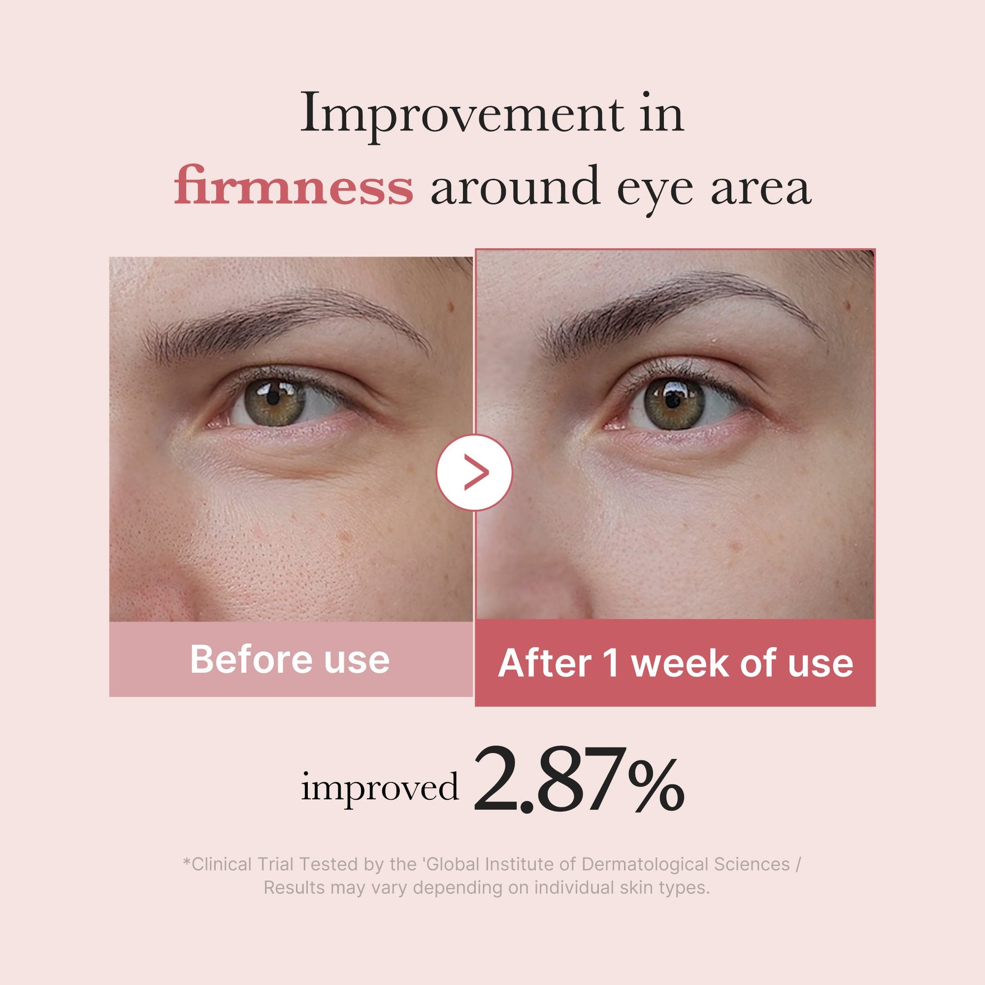 pdrn-pink-peptide-eye-cream-f4 PDRN_03_256dd753-0a2f-41b4-b3cd-bbfd3bc27018.jpg