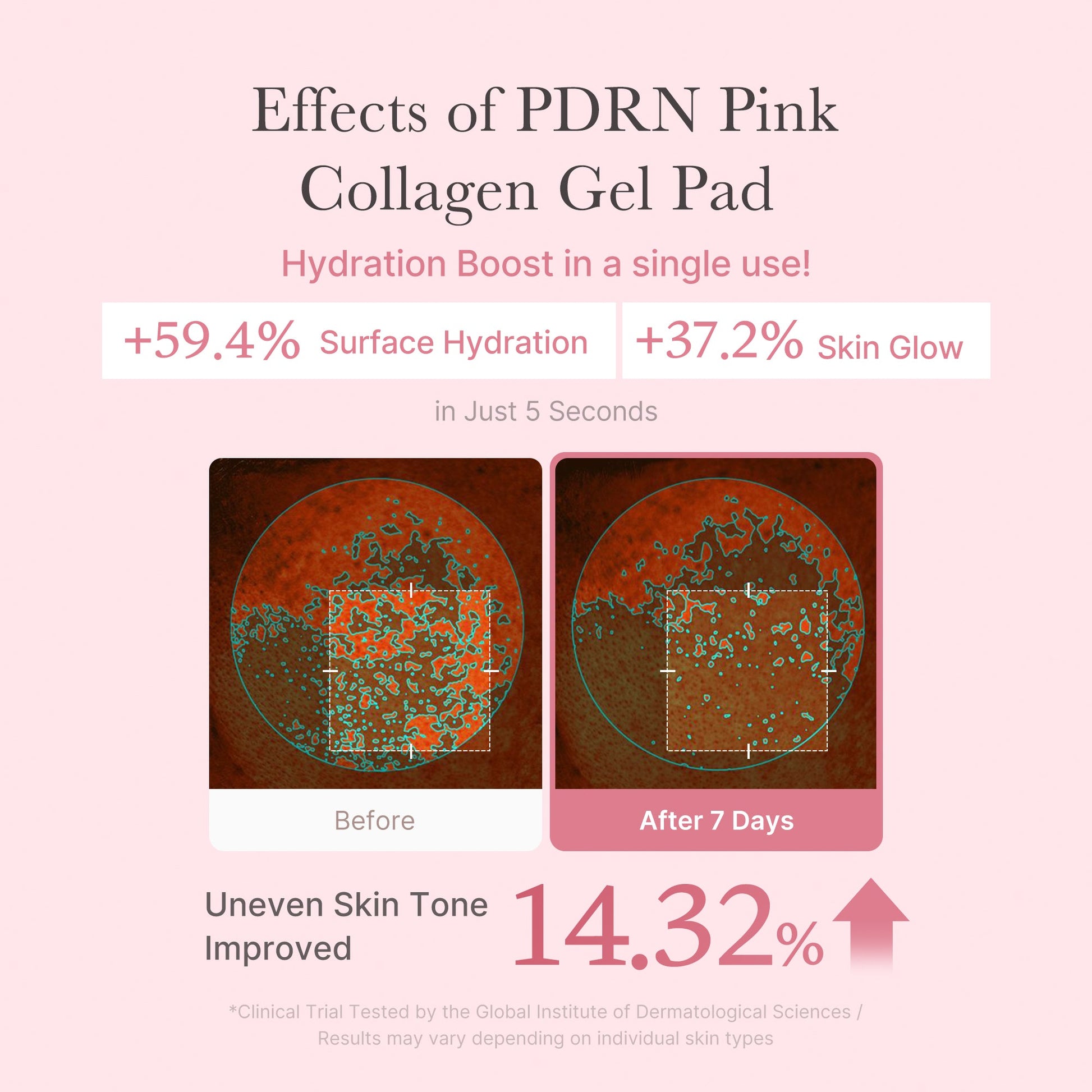 pdrn-pink-collagen-gel-toner-pad-u6 PDRN_04_f9a16a56-8d9e-4c47-a635-ed34ec3ed571.jpg