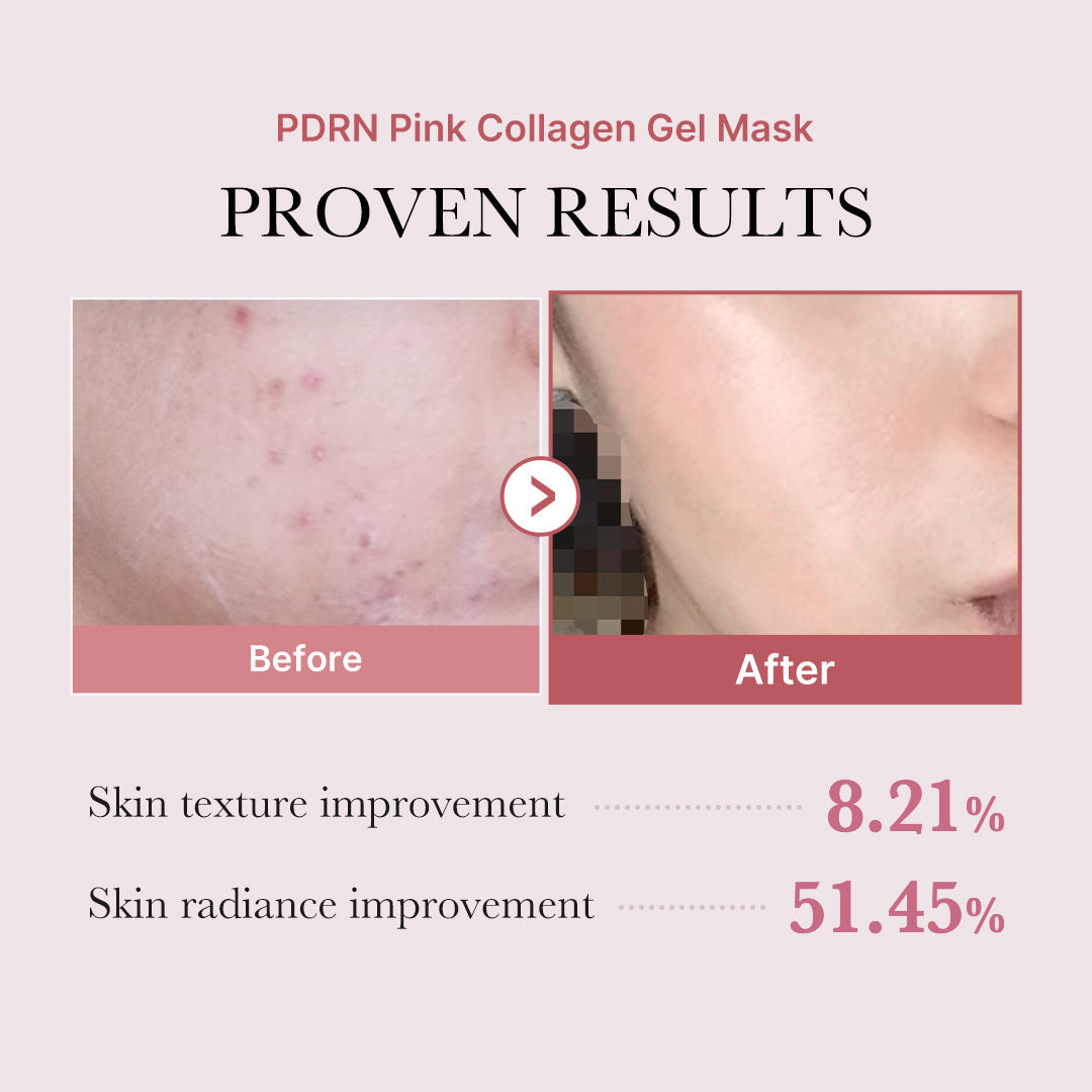 pdrn-pink-glow-full-set-n8 PDRN_12.jpg