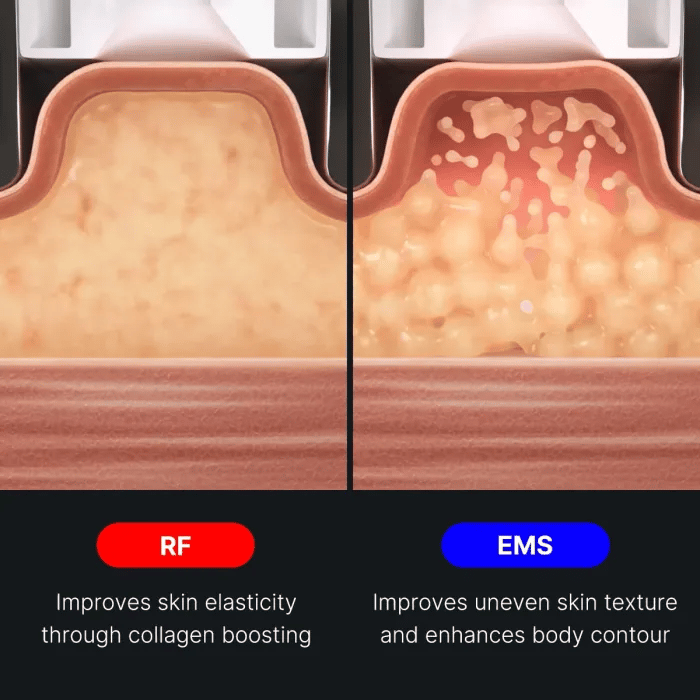 age-r-contour-body-shot-s1 img.webp